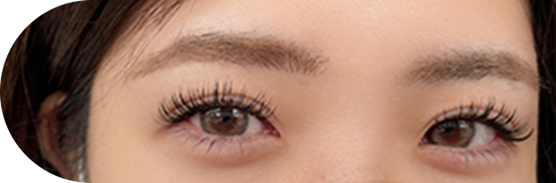 フラットラッシュのイメージ画像