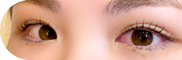 ラッシュリフトのイメージ画像